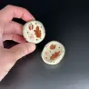 Worry stones